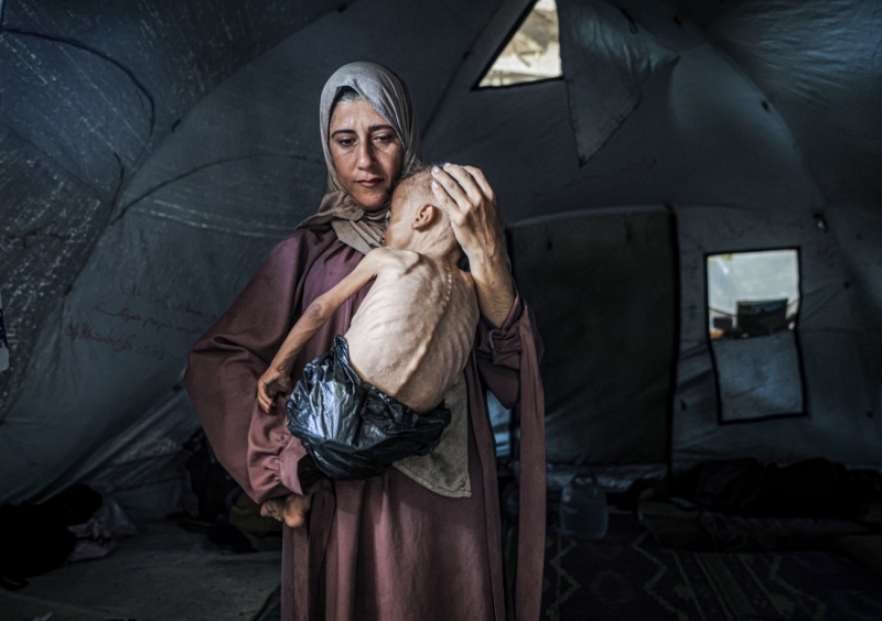 Two Years of War, Displacement, and Starvation