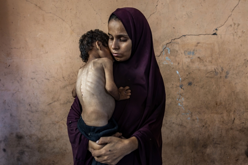 Enduring Food Deprivation